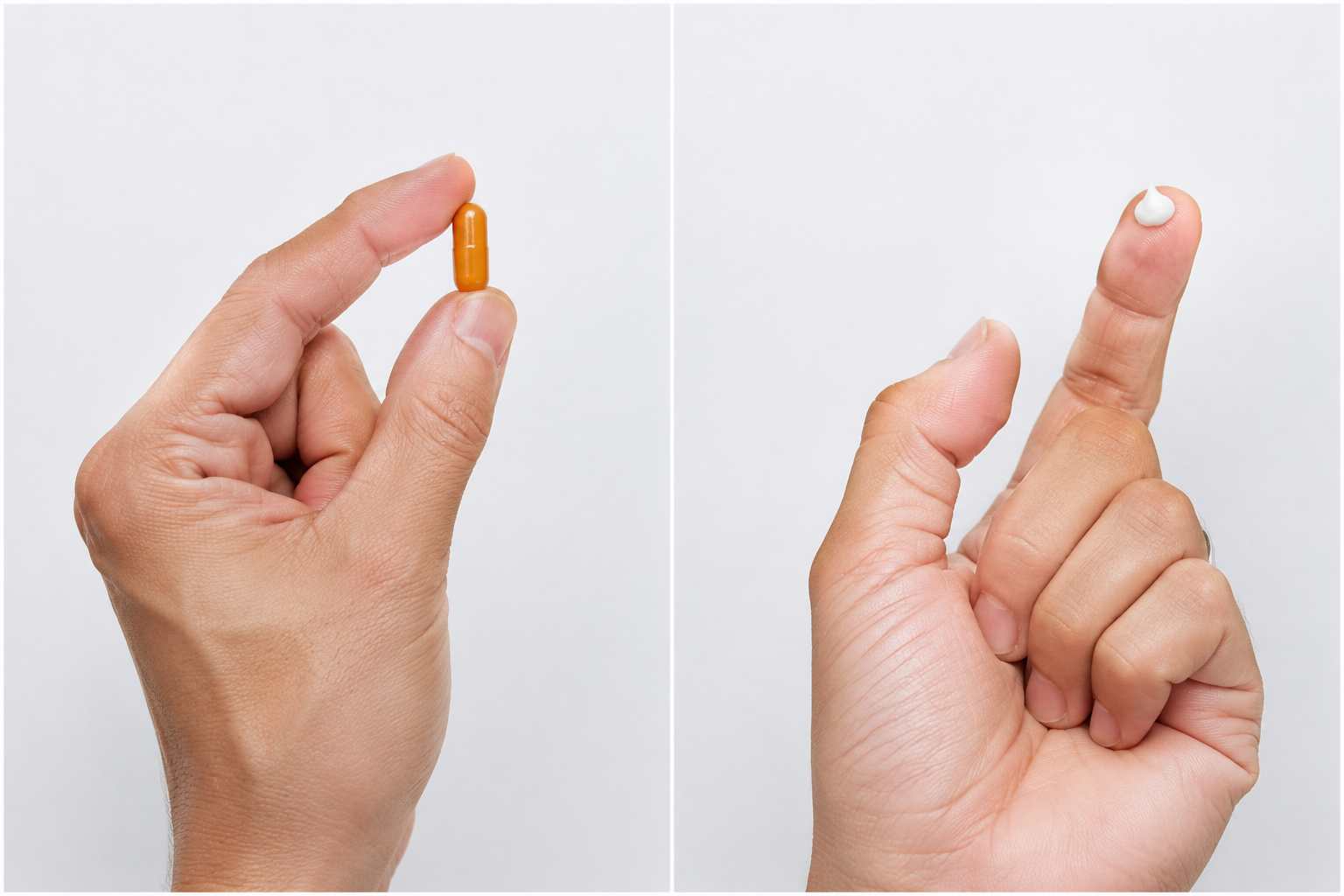 Oral isotretinoin capsule beside a fingertip with topical tretinoin cream illustrating the two delivery methods